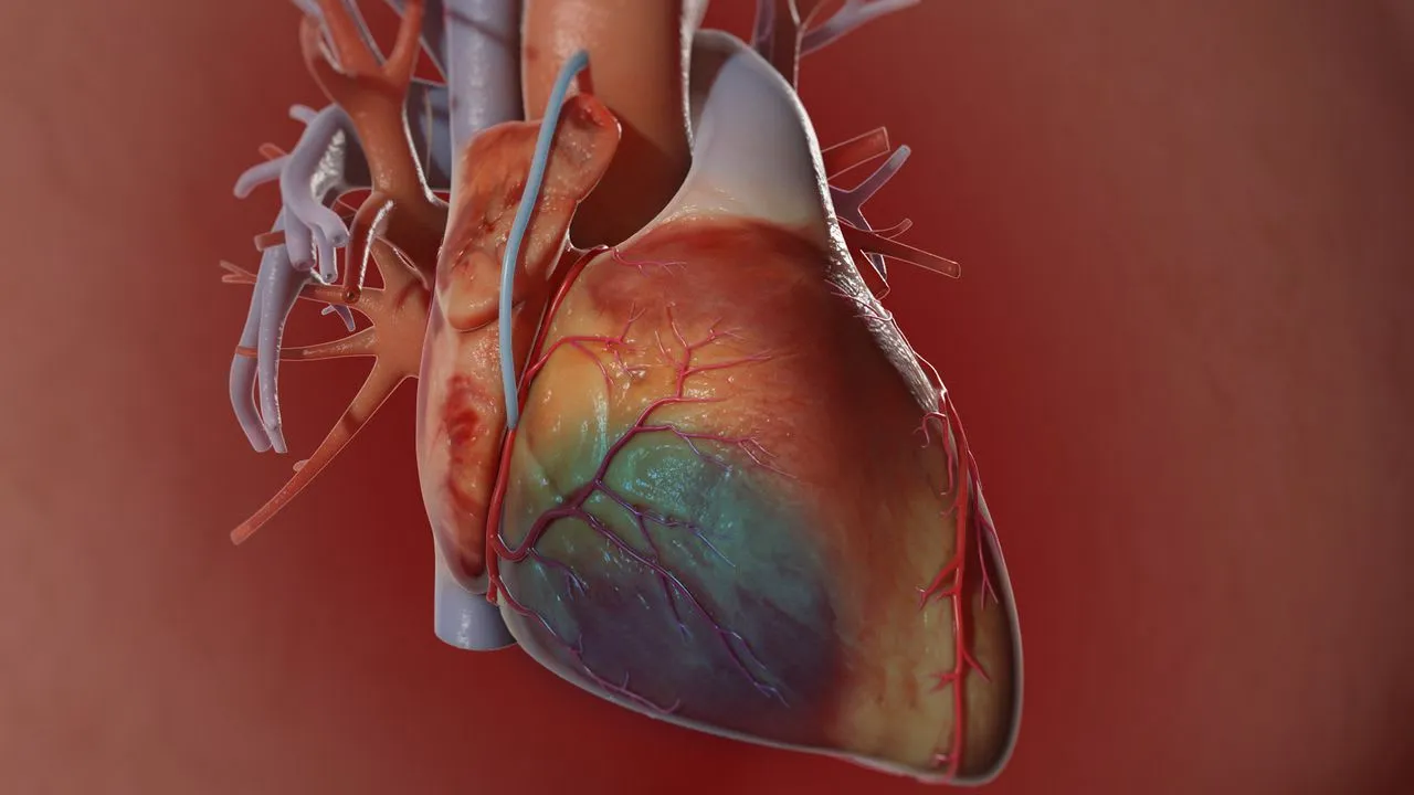 Coronary Artery Bypass Surgery